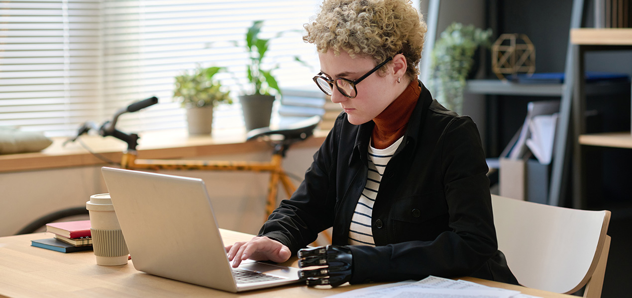 A young worker with a prosthetic arm working on their laptop.